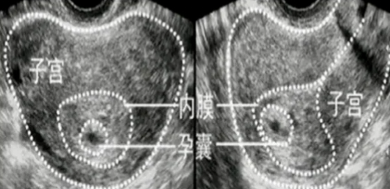 眼科ab超单怎么看1分钟带你看懂孕检B超单，解读秘籍准妈妈必备！_https://www.jmylbn.com_新闻资讯_第5张