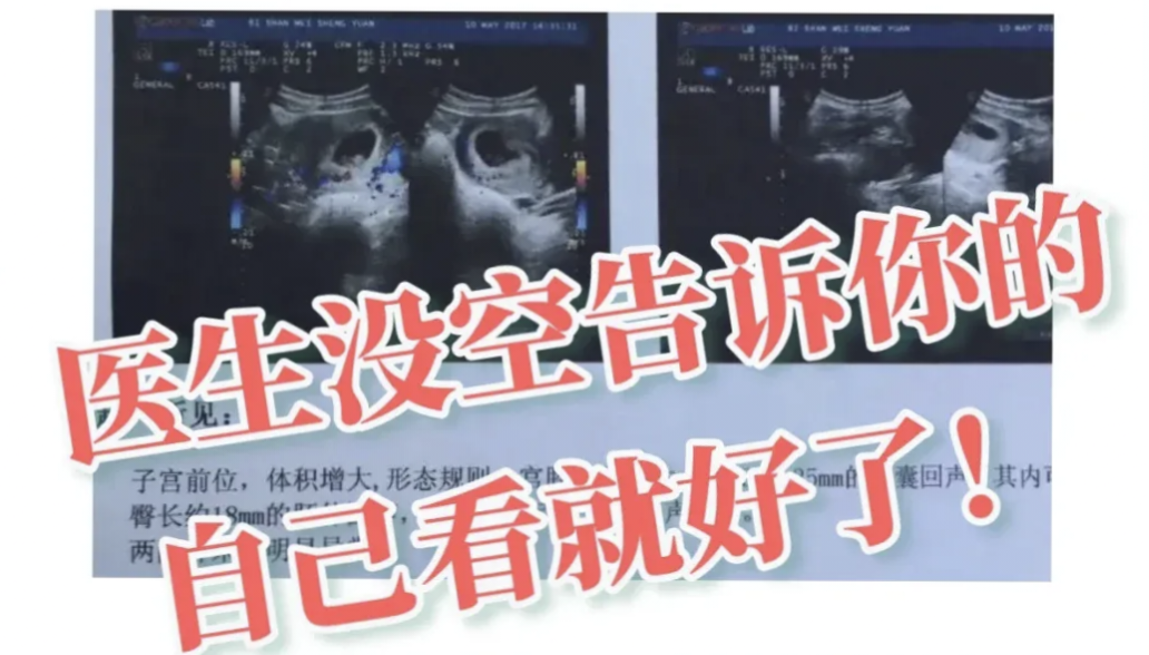 眼科ab超单怎么看1分钟带你看懂孕检B超单，解读秘籍准妈妈必备！_https://www.jmylbn.com_新闻资讯_第4张