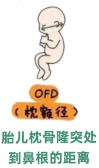 眼科ab超单怎么看1分钟带你看懂孕检B超单，解读秘籍准妈妈必备！_https://www.jmylbn.com_新闻资讯_第7张