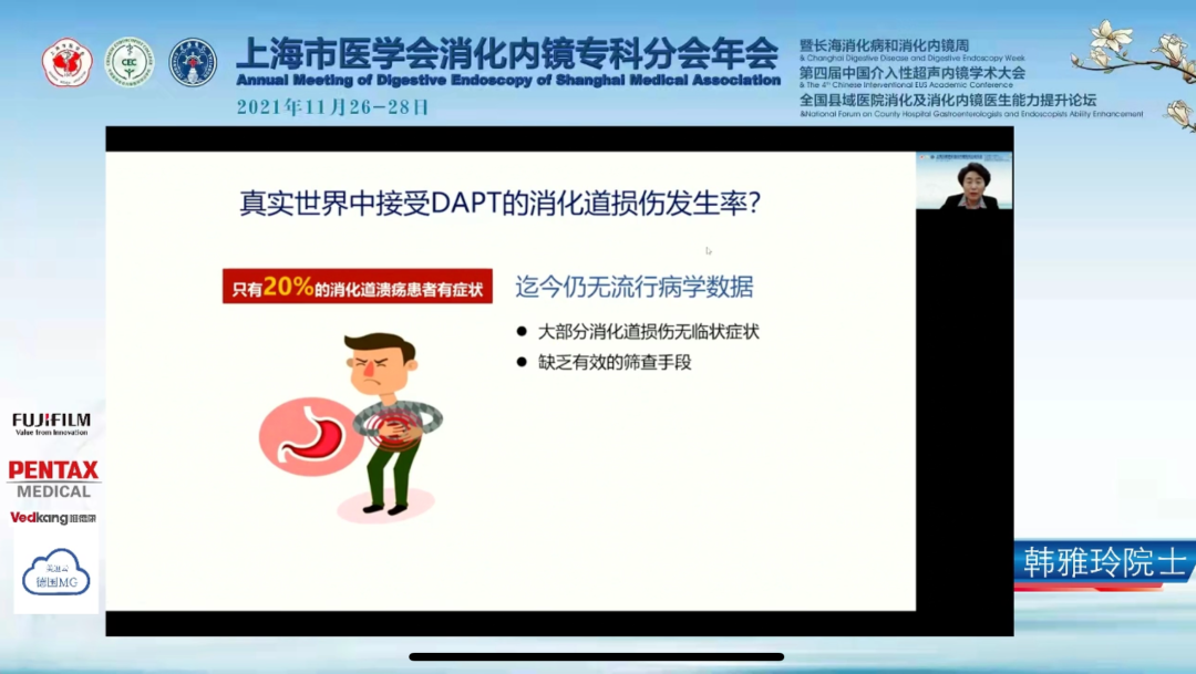血小板660有什么危害抗血小板治疗对消化道损伤的防治——磁控胶囊胃镜跨学科应用_https://www.jmylbn.com_新闻资讯_第3张