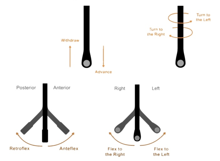 彩超探头怎么转换经食道心脏彩超（TEE）总看不懂？5 分钟掌握经典切面！（附动图）_https://www.jmylbn.com_新闻资讯_第4张