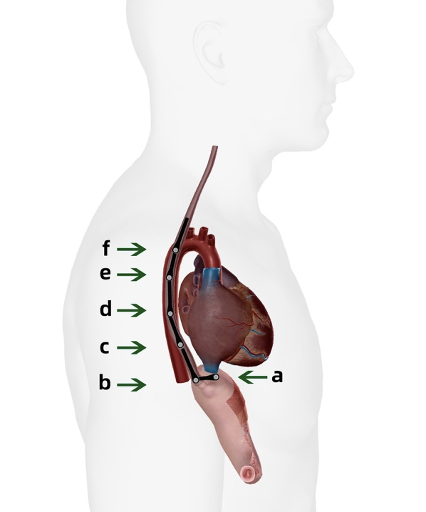 彩超探头怎么转换经食道心脏彩超（TEE）总看不懂？5 分钟掌握经典切面！（附动图）_https://www.jmylbn.com_新闻资讯_第6张