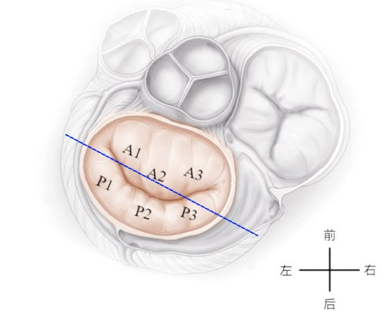 彩超探头怎么转换经食道心脏彩超（TEE）总看不懂？5 分钟掌握经典切面！（附动图）_https://www.jmylbn.com_新闻资讯_第12张