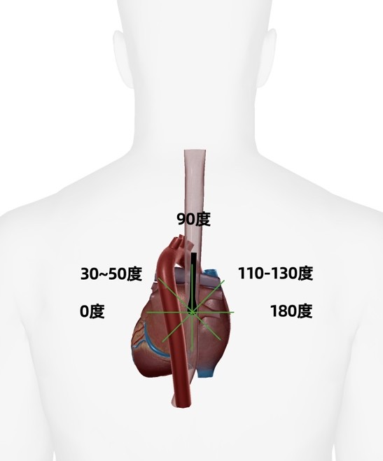 彩超探头怎么转换经食道心脏彩超（TEE）总看不懂？5 分钟掌握经典切面！（附动图）_https://www.jmylbn.com_新闻资讯_第7张