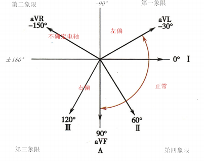 4 种判定心电轴偏移方法 你知道几种 心电视频第6 期 心血管时间 微信公众号文章阅读 Wemp