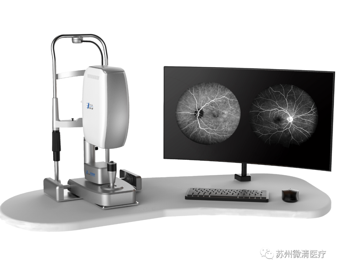 怎么看眼底相机微清Apollo相机，揭开白内障眼底的神秘面纱_https://www.jmylbn.com_新闻资讯_第16张