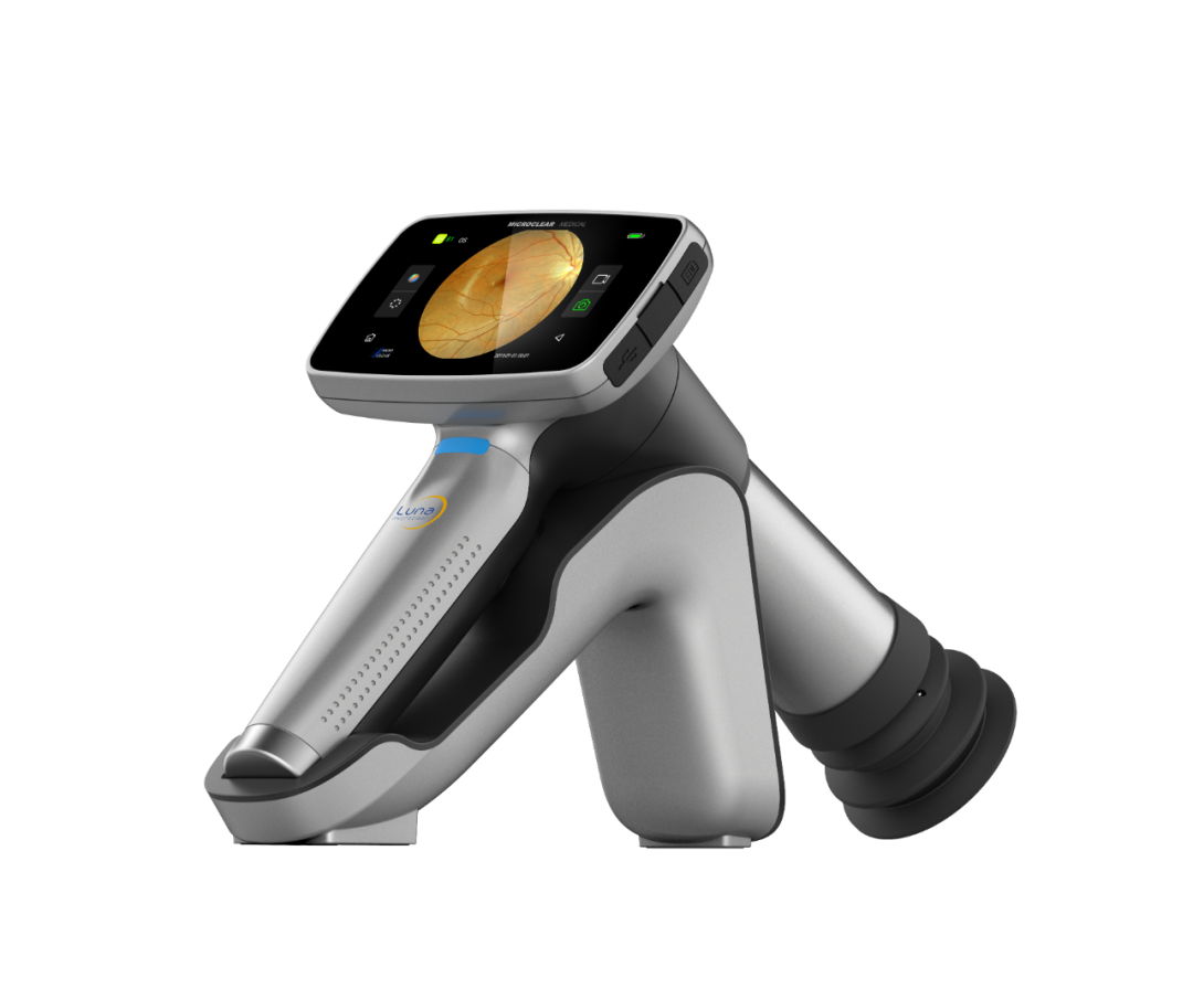 手持眼底相机怎么用“视”关重要——眼底照相检查_https://www.jmylbn.com_新闻资讯_第12张