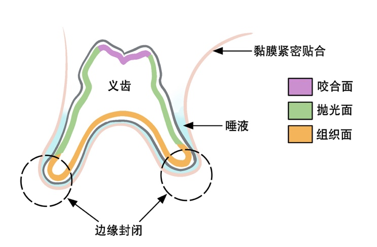 口腔吸盘怎么安装口腔科普丨吸附性全口义齿是什么？_https://www.jmylbn.com_新闻资讯_第7张