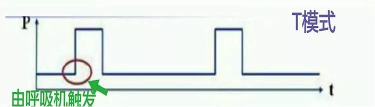 呼吸机ac是什么意思【ICU笔记】无创呼吸机不会用？看完打通任督二脉_https://www.jmylbn.com_新闻资讯_第3张