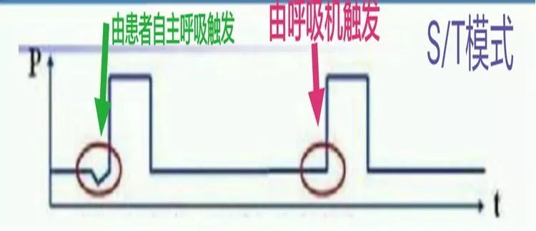 呼吸机ac是什么意思【ICU笔记】无创呼吸机不会用？看完打通任督二脉_https://www.jmylbn.com_新闻资讯_第4张