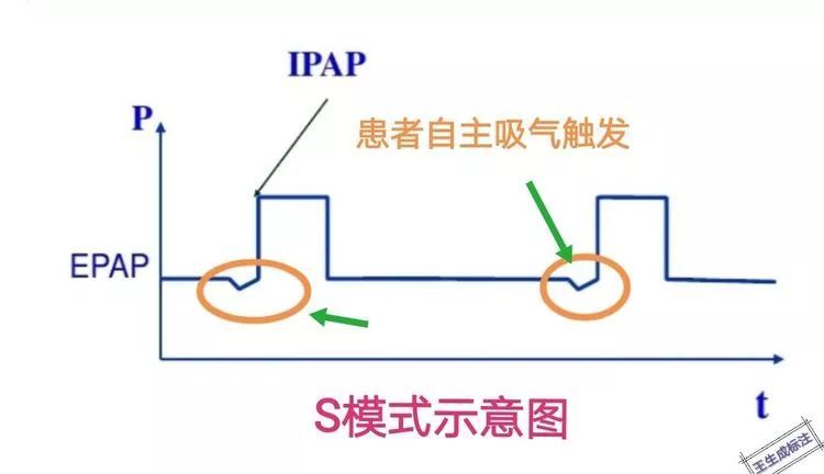 呼吸机ac是什么意思【ICU笔记】无创呼吸机不会用？看完打通任督二脉_https://www.jmylbn.com_新闻资讯_第2张