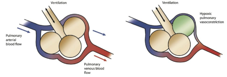 吸氧应该什么浓度慢阻肺患者鼻导管吸氧5L／min，结果...._https://www.jmylbn.com_新闻资讯_第8张