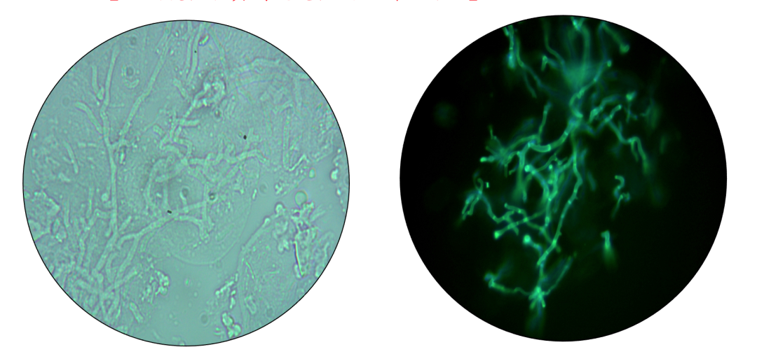 妇科荧光检查是什么会发“光”的技术：”真菌荧光检测“——汾阳医院皮肤性病科实验室成功开展“真菌荧光检测”新项目_https://www.jmylbn.com_新闻资讯_第4张