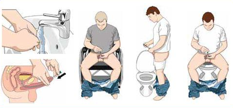 为什么要引流尿袋做手术插尿管，这种感觉“酸爽”吗，需要注意哪些问题？_https://www.jmylbn.com_新闻资讯_第17张