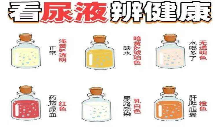 为什么要引流尿袋做手术插尿管，这种感觉“酸爽”吗，需要注意哪些问题？_https://www.jmylbn.com_新闻资讯_第19张