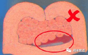 端子剖面不良分析及解决方案的图36