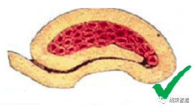 端子剖面不良分析及解决方案的图40
