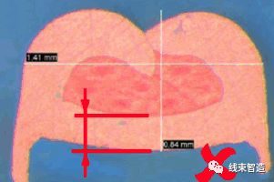 端子剖面不良分析及解决方案的图11