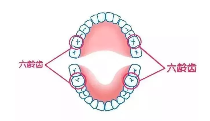 SOS！来自六龄齿的呼救！