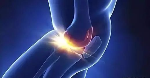 滑膜炎能治除根吗？骨膜炎最佳治疗方法这样做可以有效治疗