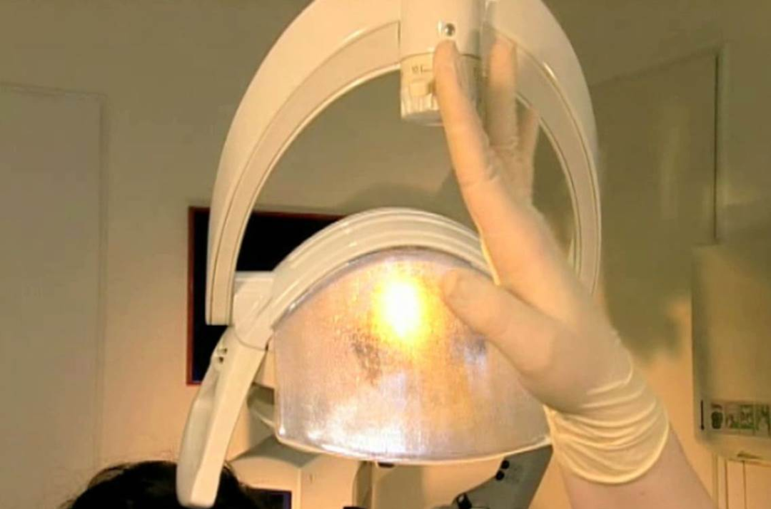 dmg口腔材料怎么使用DMG-Icon专利之渗透树脂（内含操作视频）_https://www.jmylbn.com_新闻资讯_第11张