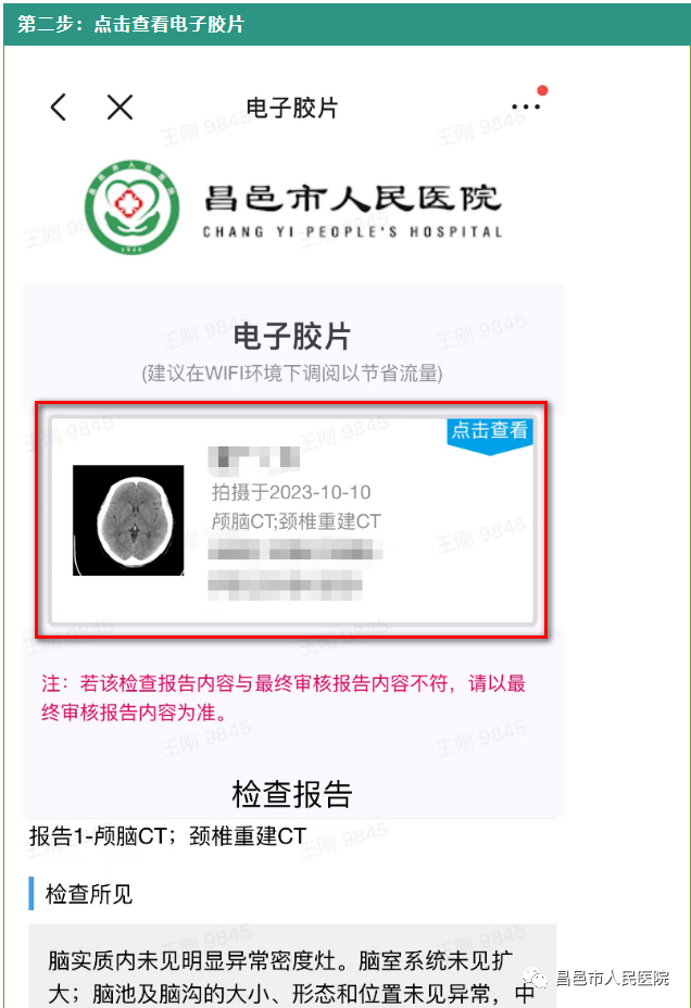 怎么自助取胶片医院【便民服务】快看！昌邑市人民医院“电子胶片”上线了！手机扫一扫，取片不用跑！_https://www.jmylbn.com_新闻资讯_第8张