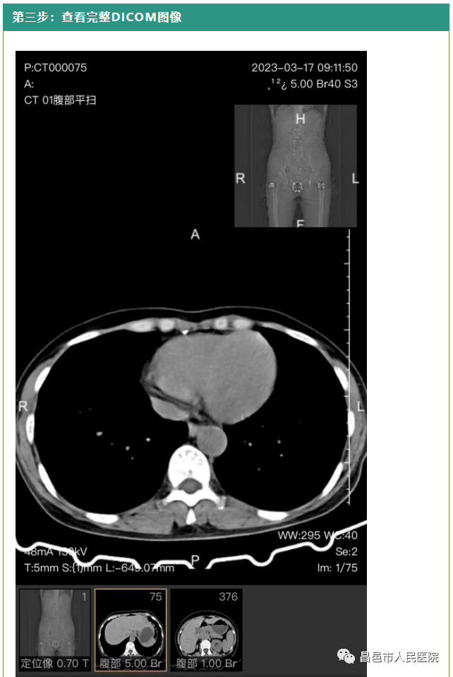 怎么自助取胶片医院【便民服务】快看！昌邑市人民医院“电子胶片”上线了！手机扫一扫，取片不用跑！_https://www.jmylbn.com_新闻资讯_第9张