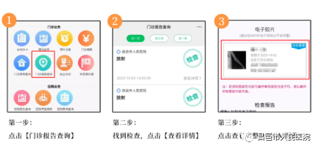 怎么自助取胶片医院【便民服务】快看！昌邑市人民医院“电子胶片”上线了！手机扫一扫，取片不用跑！_https://www.jmylbn.com_新闻资讯_第6张