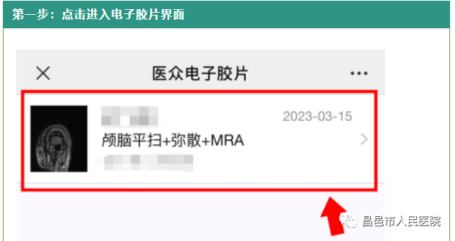 怎么自助取胶片医院【便民服务】快看！昌邑市人民医院“电子胶片”上线了！手机扫一扫，取片不用跑！_https://www.jmylbn.com_新闻资讯_第7张