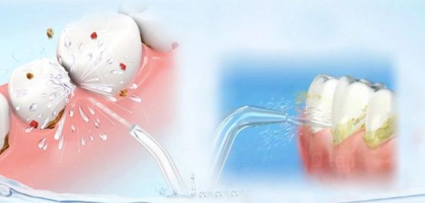 那些年，我们让洗牙背的锅