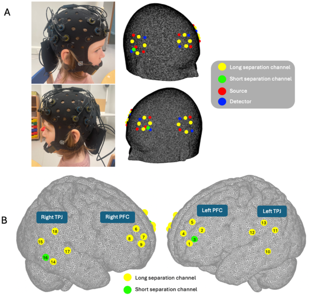 發(fā)展性 fNIRS 超掃描數(shù)據(jù)分析流程優(yōu)化：4-6 歲兒童與母親協(xié)作神經(jīng)連貫性