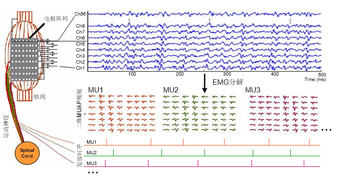 康复大学周平教授团队高密度表面肌电信号分解综述