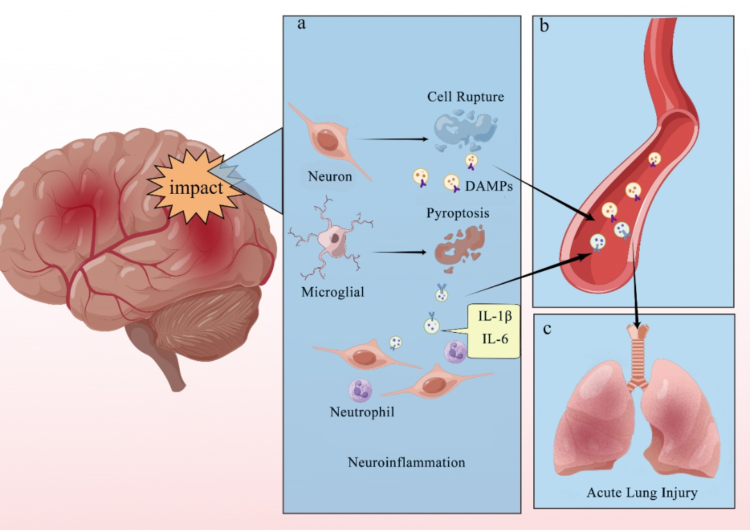 怎么销售透化治疗系统Mol Neurobiol 综述︱温州医科大学倪文飞／周凯亮团队关注细胞外囊泡在治疗中枢神经系统创伤中的重要作用_https://www.jmylbn.com_新闻资讯_第4张