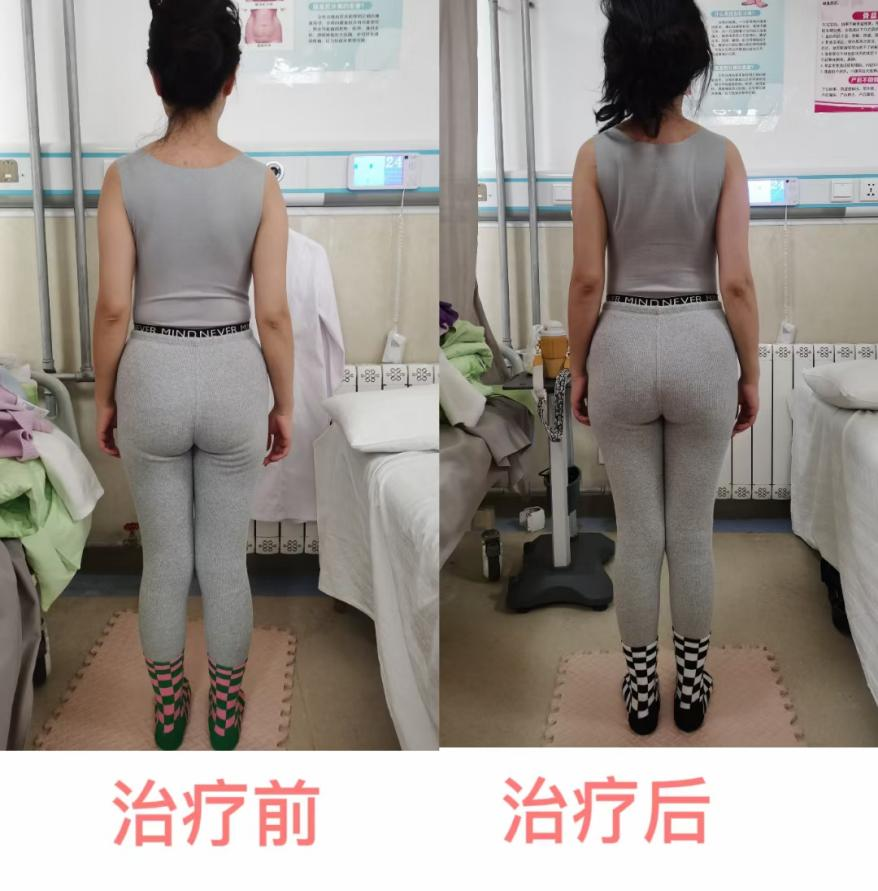 产后康复治疗是什么安顺市中医院康复科特色疗法之二：系统治疗助“女”产后康复_https://www.jmylbn.com_新闻资讯_第6张