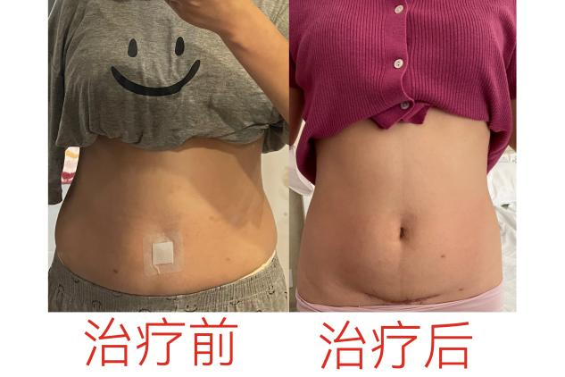 产后康复治疗是什么安顺市中医院康复科特色疗法之二：系统治疗助“女”产后康复_https://www.jmylbn.com_新闻资讯_第8张