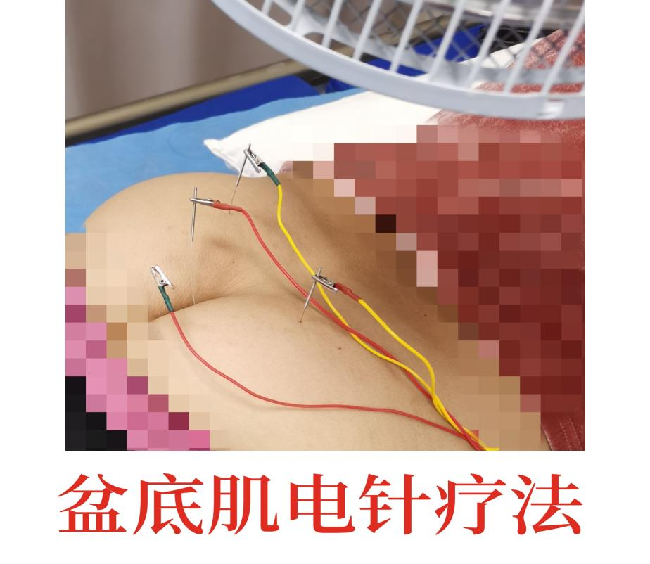 产后康复治疗是什么安顺市中医院康复科特色疗法之二：系统治疗助“女”产后康复_https://www.jmylbn.com_新闻资讯_第4张