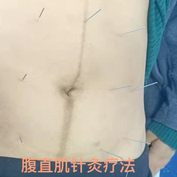 产后康复治疗是什么安顺市中医院康复科特色疗法之二：系统治疗助“女”产后康复_https://www.jmylbn.com_新闻资讯_第5张