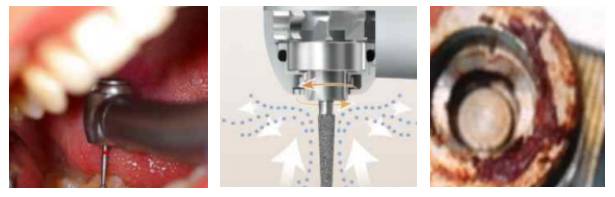 为什么口腔叫手机为什么牙科手机灭菌前需要彻底的清洗？_https://www.jmylbn.com_新闻资讯_第2张