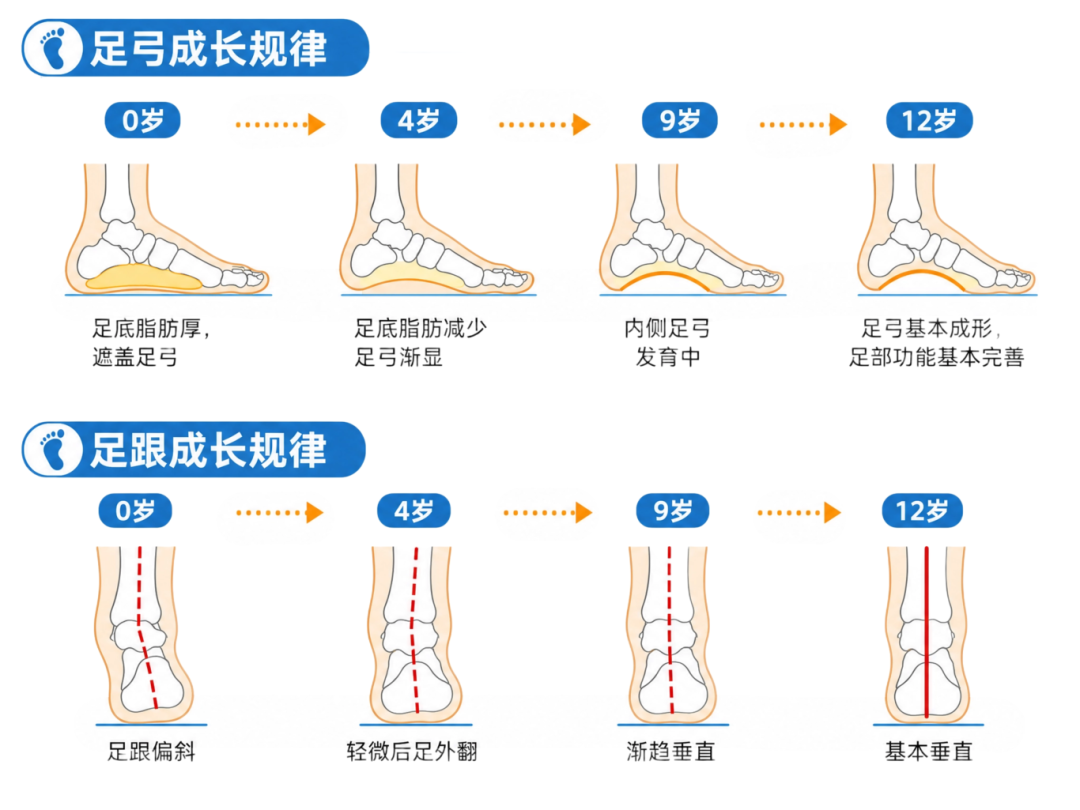 儿童足部发育示意图.png
