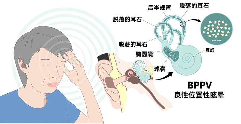 e250bb012f9d83948f2ee6380cae7b9a.png