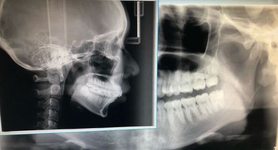 为什么牙医不用开口器有一种靠谱的牙医，就是不轻易对你下结论_https://www.jmylbn.com_新闻资讯_第6张