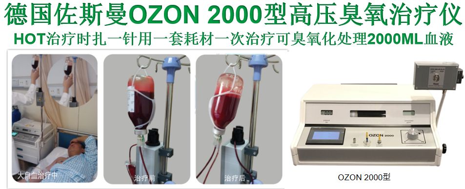 高压臭氧治疗什么经过6次高剂量高压三氧自血疗法(HOT)血脂明显下降!_https://www.jmylbn.com_新闻资讯_第1张