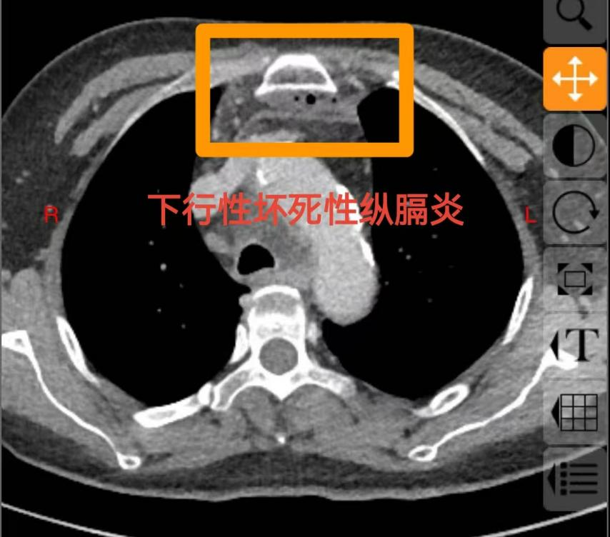 图片3.png