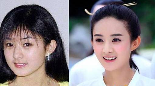 相比宋慧乔的抬头纹 鹿晗颜值大崩看得让人真尴尬 亚韩整形 微信公众号文章阅读 Wemp