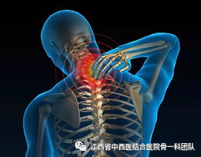 医用颈托怎么戴如何正确佩戴颈托_https://www.jmylbn.com_新闻资讯_第1张