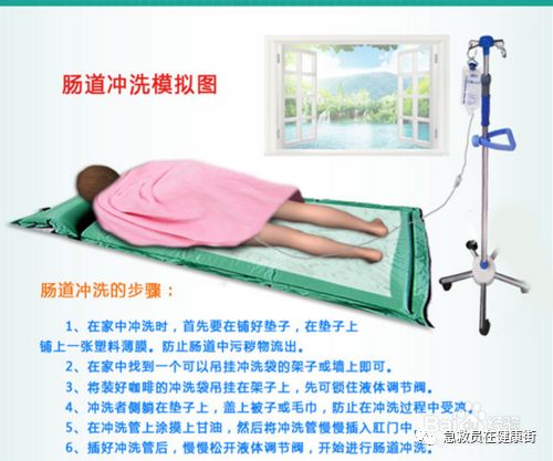 怎么无器材灌肠灌肠术（一）_https://www.jmylbn.com_新闻资讯_第41张