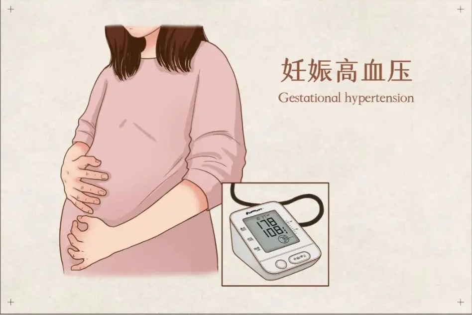 妊高症监测是什么【孕妇学校】妊高症检测仪——守护母婴健康_https://www.jmylbn.com_新闻资讯_第16张