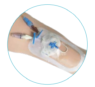 picc导管是什么材质【健康科普】什么是PICC？_https://www.jmylbn.com_新闻资讯_第19张