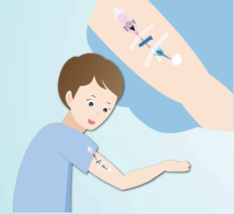 picc导管是什么材质【健康科普】什么是PICC？_https://www.jmylbn.com_新闻资讯_第9张