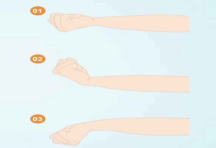 picc导管是什么材质【健康科普】什么是PICC？_https://www.jmylbn.com_新闻资讯_第31张